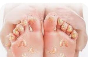 पैर शरीर के वफादार अंग हैं।